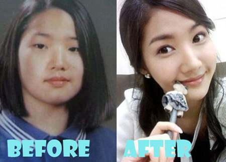 Before and after look at the changes made to Park Min Young nose.